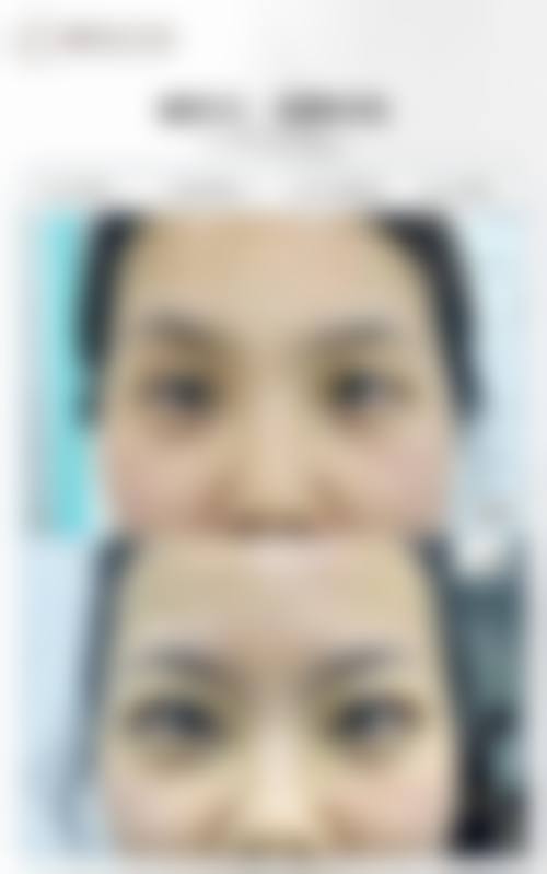 【汉中沐宁医疗美容门诊部真实患者评价】