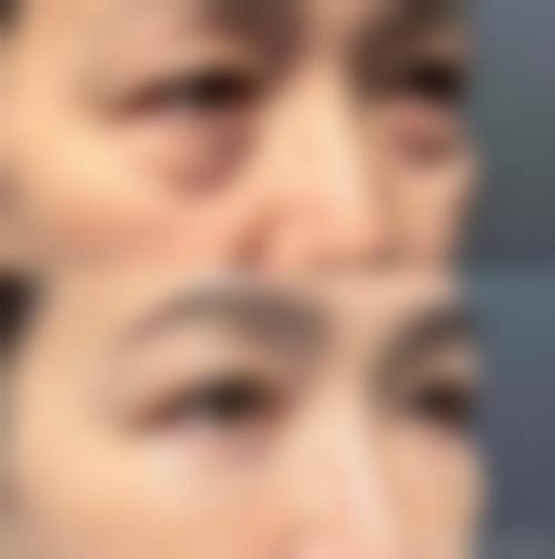 【北京臻瑞奥美医疗美容诊所真实患者评价】