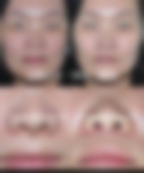 【惠州星泷整形医院擅长项目有哪些?】