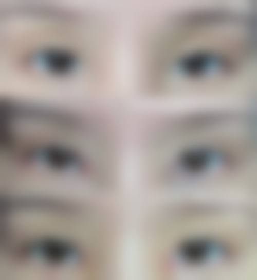 【成都精美源整形医院真实患者评价】