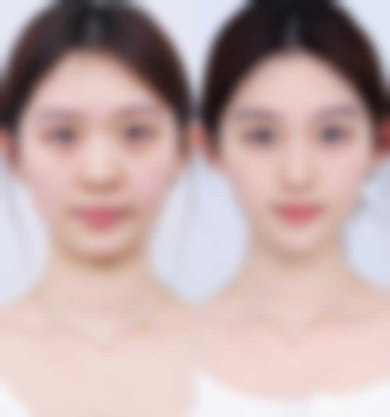 易先锋擅长项目列表