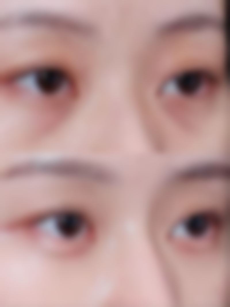【荆州汇美医疗美容诊所擅长项目有哪些?】