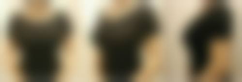 【潍坊市人民医院美容整形科真实患者评价】