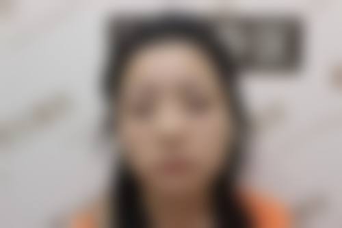 【西藏玛丽亚天府国内外医学美容医院擅长项目有哪些？】