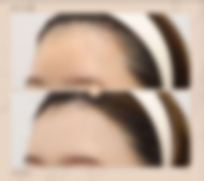 【吉林美辰医疗美容医院真实患者评价】
