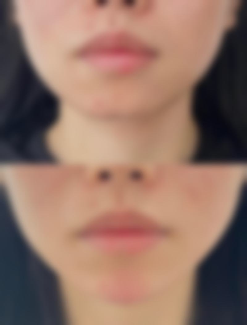 【北京小真美人整形医院擅长项目有哪些?】
