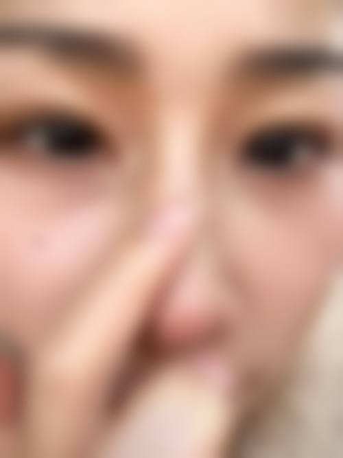 【鞍山润美整形医院交通路线及预约方式】