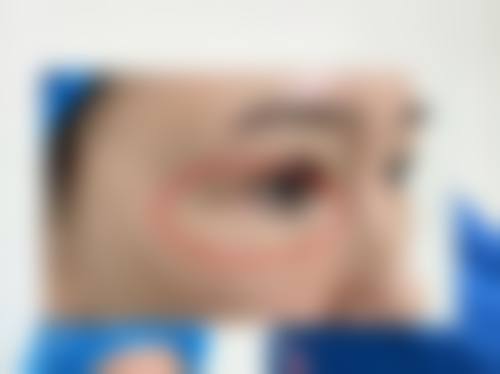 【长治亮丽整形医疗美容门诊部真实患者评价】