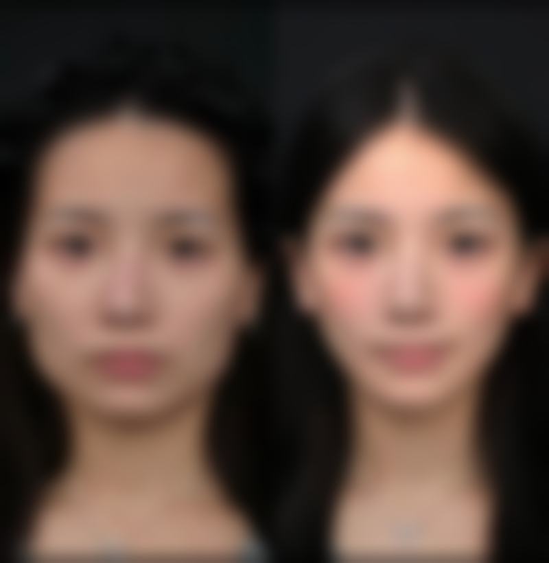 【靖江皇开医疗美容诊所擅长项目有哪些？】