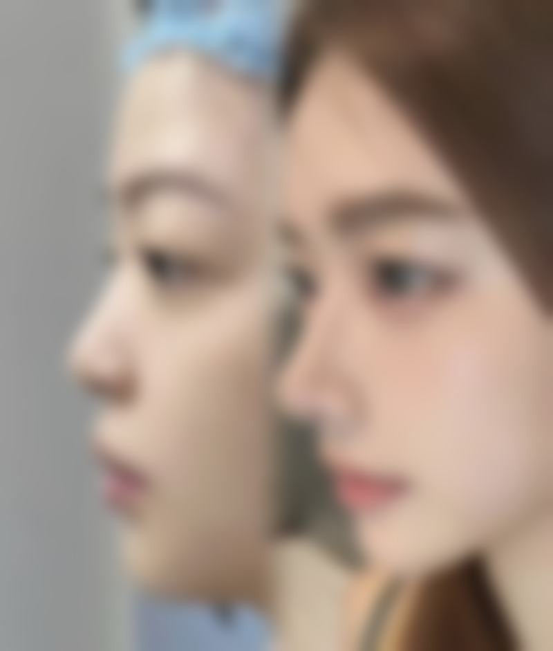 【鞍山润美整形医院擅长项目有哪些？】