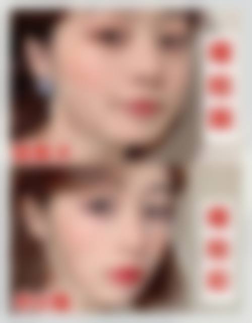 【顺德大良东康整形门诊部擅长项目有哪些?】