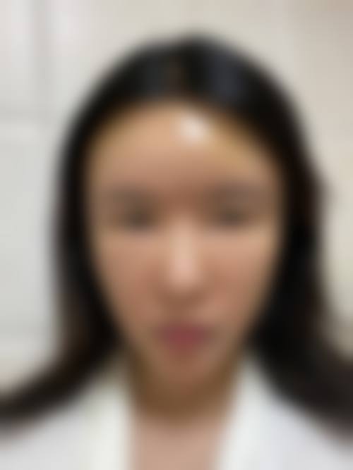 【成都蒋氏白大夫医疗美容诊所真实患者评价】
