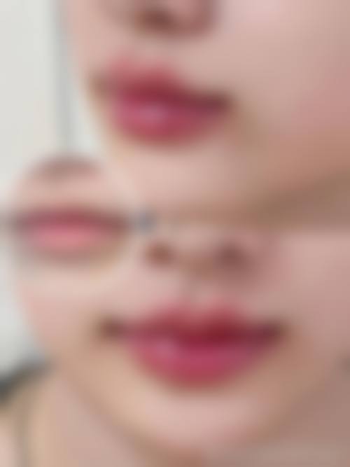 【北京应急总医院整形美容科擅长项目有哪些？】