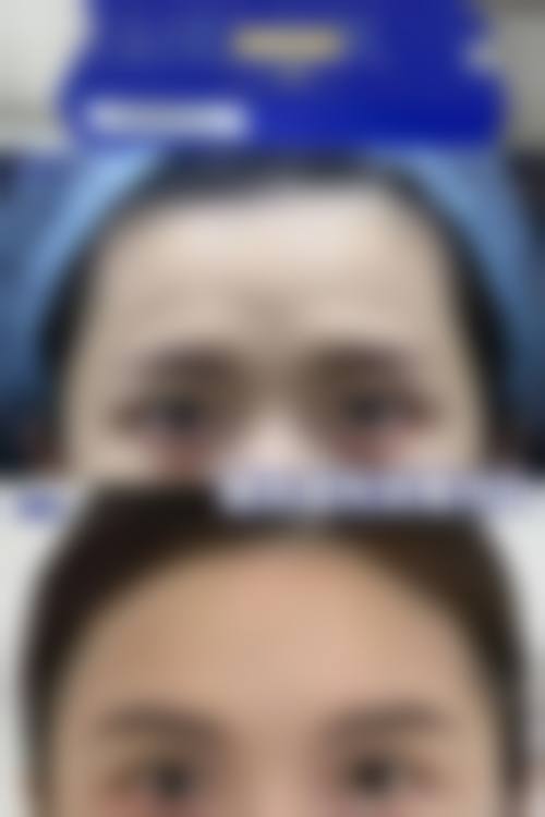 【沈阳刘海冰医疗美容诊所真实患者评价】