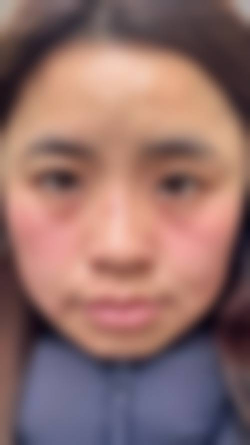 【无锡朵美整形医疗美容擅长项目有哪些?】
