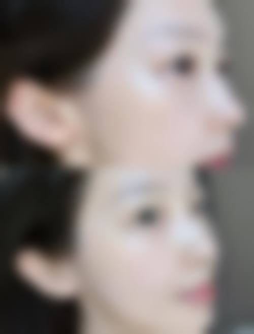 【深圳星美度整形医院真实患者评价】