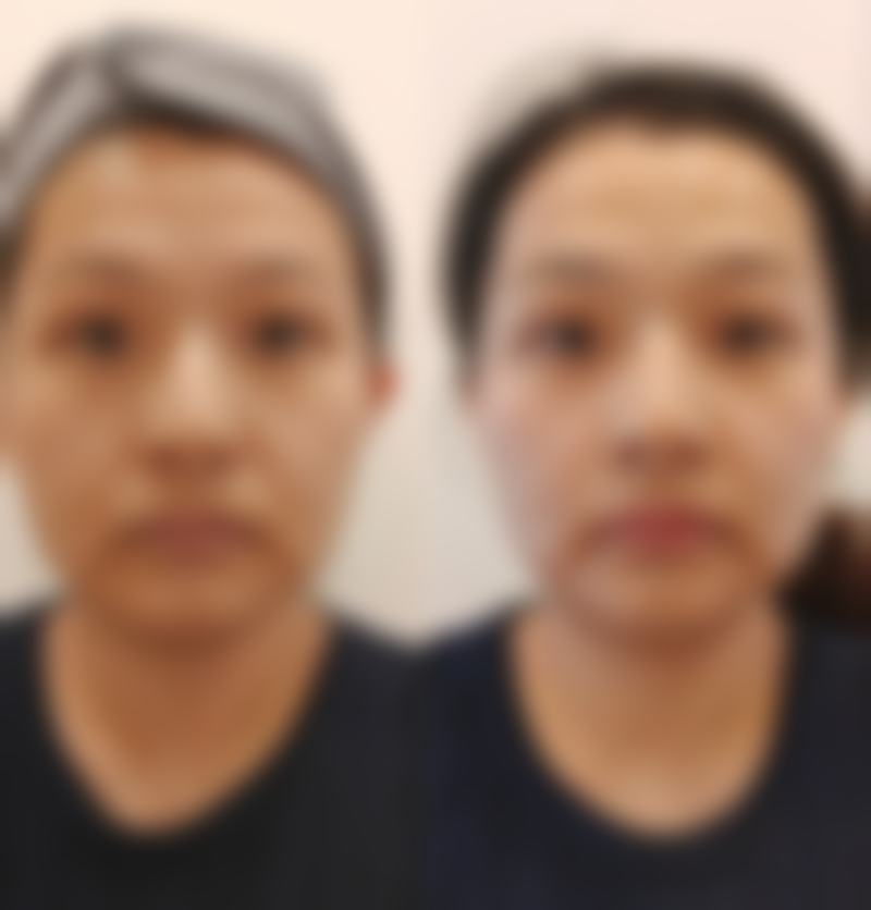 【湖北芯微医疗美容门诊部真实患者评价】