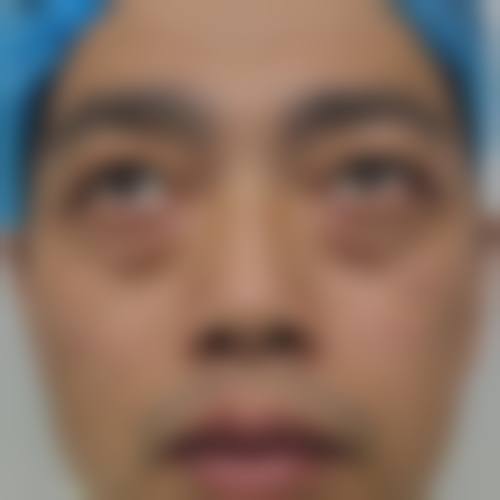 【2026肇庆市皮肤病医院医疗美容科项目价格参考】
