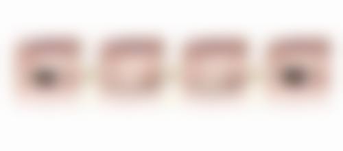 【成都高新致臻爱医疗美容门诊部擅长项目有哪些？】