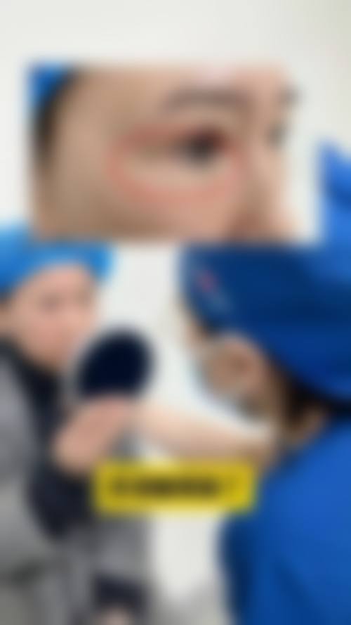 【沈阳唯美付强整形医院真实患者评价】