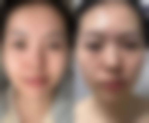 【成都轻安美育整形医院交通路线及预约方式】