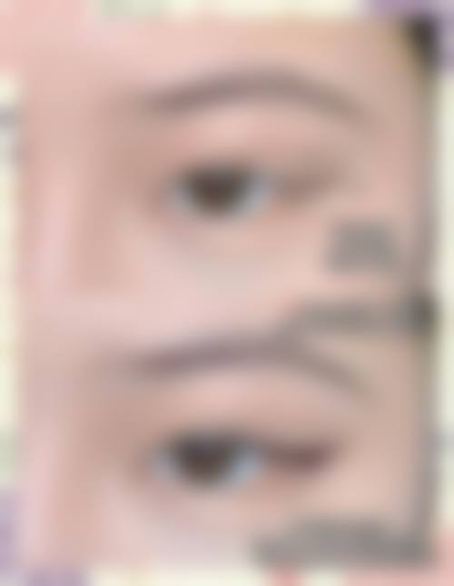 【韩国菲斯普乐斯Faceplus整形外科擅长项目有哪些?】