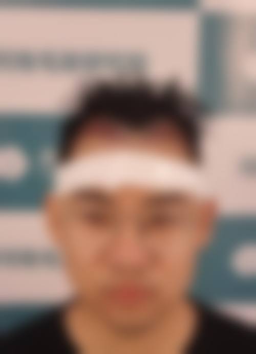 【韩国菲斯普乐斯Faceplus整形外科真实患者评价】
