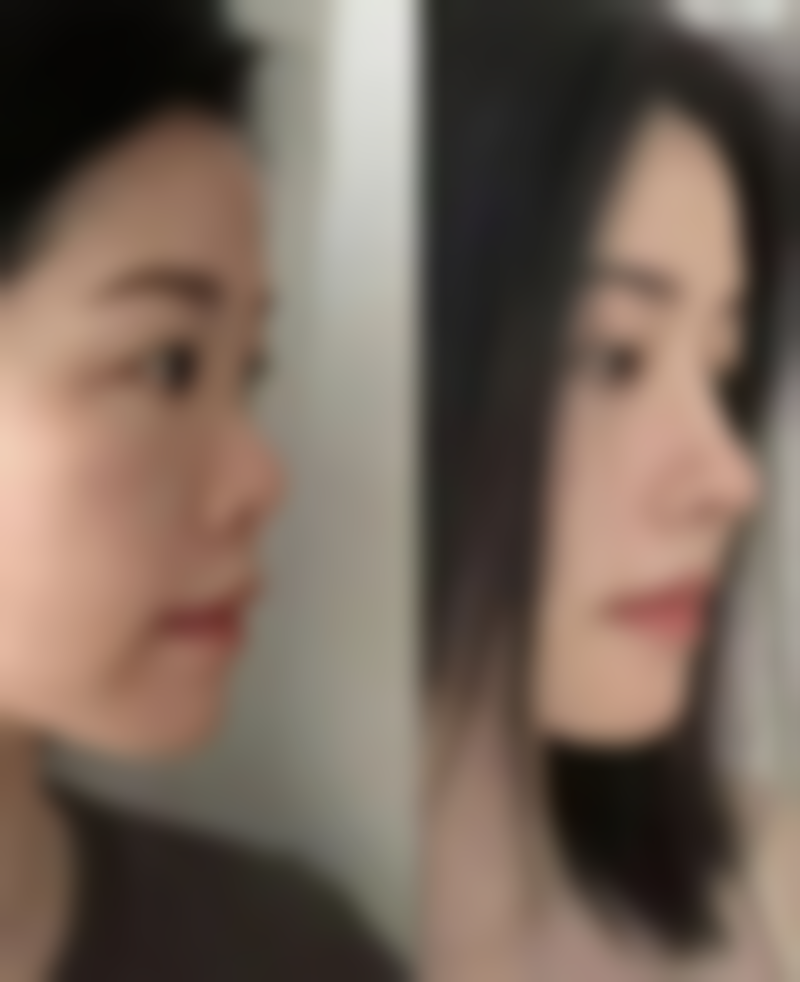 【广州星耀医疗美容诊所擅长项目有哪些?】