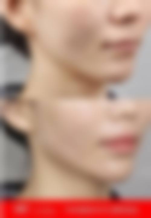 【南京东南大学附属中大医院烧伤整形科擅长项目有哪些？】