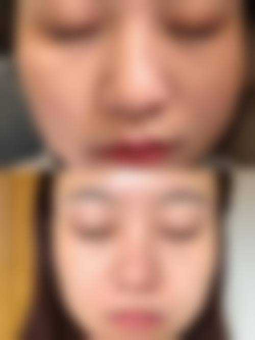 【2026杭州苹佳瓒美医疗美容门诊部项目价格参考】