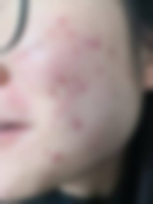 【杭州苹佳瓒美医疗美容门诊部硬件与特色优势】