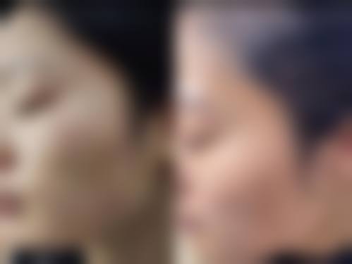 【柳州美丽焦点医疗美容门诊部真实患者评价】