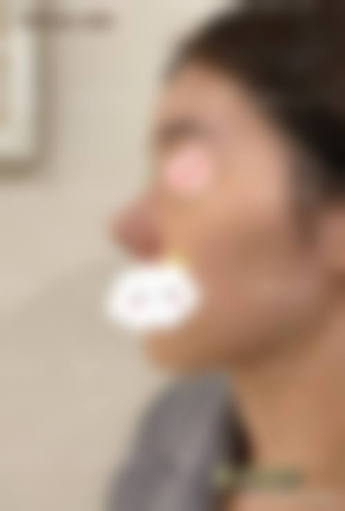 【柳州美丽焦点医疗美容门诊部擅长项目有哪些？】