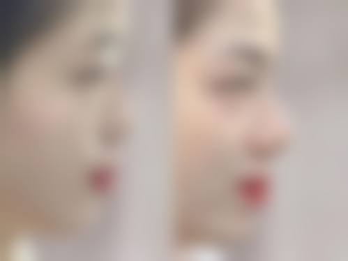 【六、内蒙古盛禧医疗美容门诊部真实患者口碑评价】