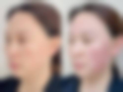 【二、哈医 大四院美容科擅长诊疗项目有哪些】