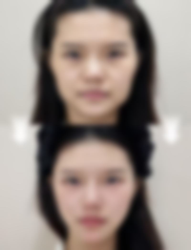 陈巧患者评价