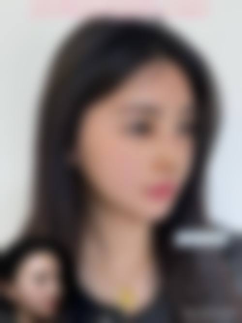 【六、东莞君熠医疗美容整形医院真实患者口碑评价】