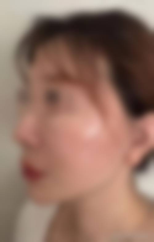 【六、南通智美医疗美容门诊部真实患者口碑评价】