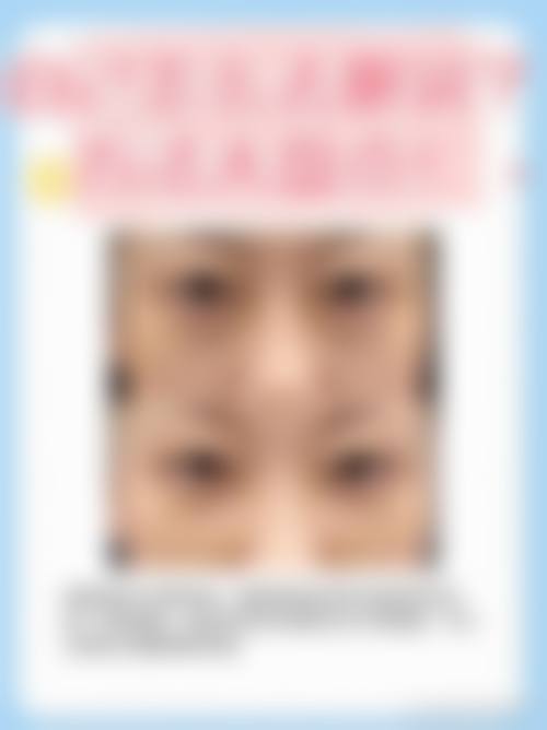【四、2026 韩国安娜柯琳整形外科项目收费价格参考】