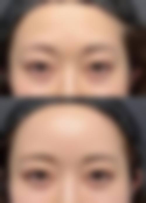 【六、东莞轻颜丽美整形医院真实患者口碑评价】