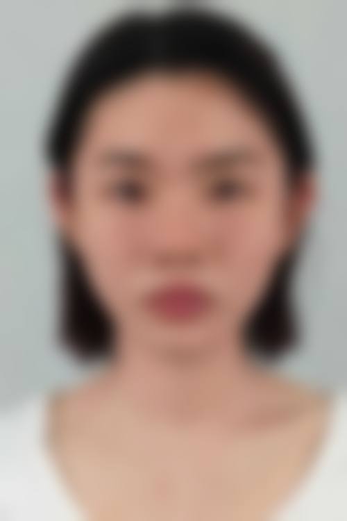 【六、成都焕颜医疗美容门诊部真实患者口碑评价】