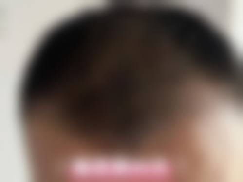 【二、孝感安丽尔医疗美容诊所擅长诊疗项目有哪些】