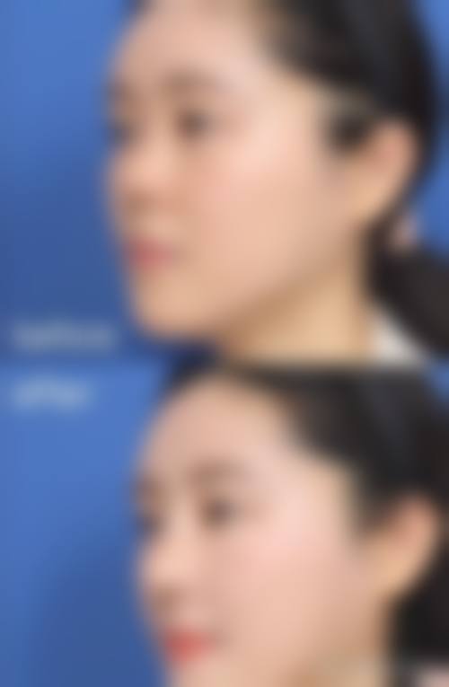 【六、韩国博乐丝（plus）整形医院真实患者口碑评价】