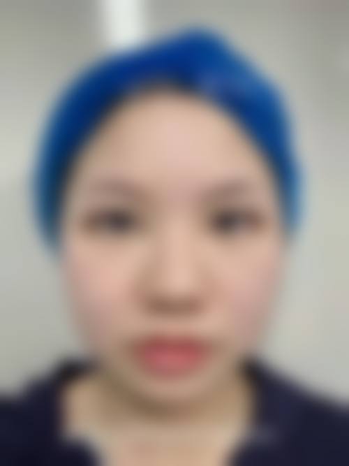 【六、湖北恩施天后整形医院真实患者口碑评价】