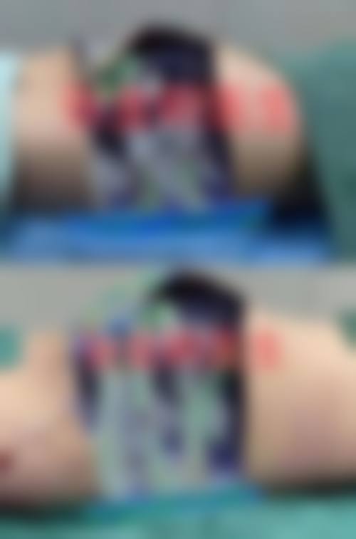 【六、拉本整形外科真实患者口碑评价】