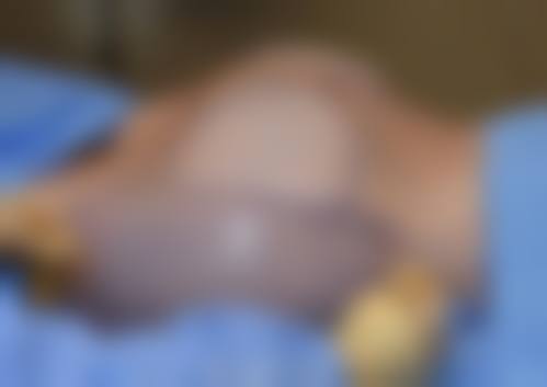 【二、拉本整形外科擅长诊疗项目有哪些】