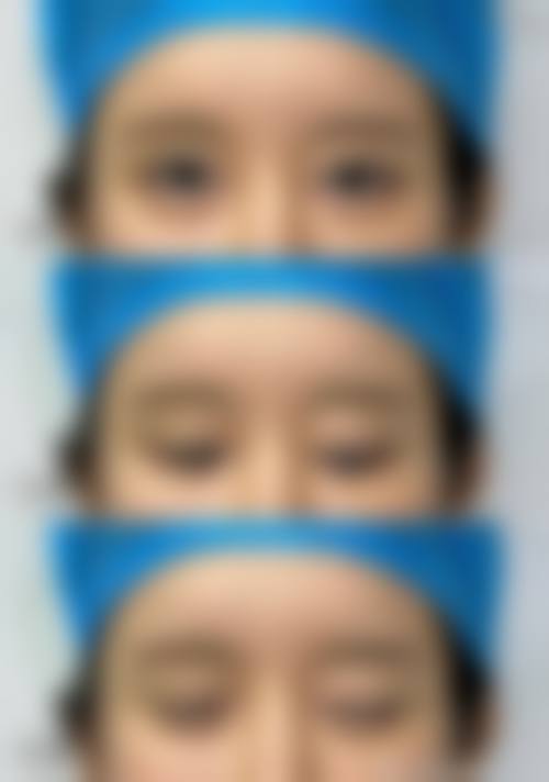 【二、临沂兰山微美医疗美容门诊部擅长诊疗项目有哪些】