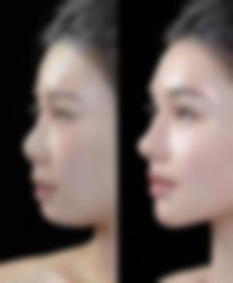 【四、2026 亳州缔莱美医疗美容门诊部项目收费价格参考】