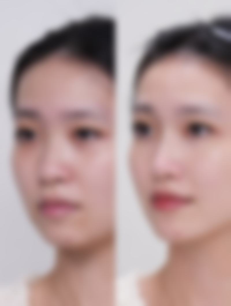 【三、铁岭张涛整形医院骨干医生团队与技术标准】