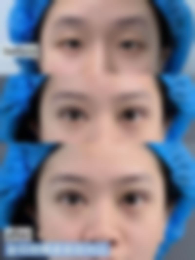 【六、贵阳观山湖垚焱医疗美容门诊部真实患者口碑评价】